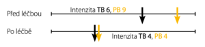 Kazuistika 2 – trvalá (TB) a průlomová (PB) bolest před léčbou a po ní