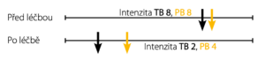 Kazuistika 1 – trvalá (TB) a průlomová (PB) bolest před léčbou a po ní