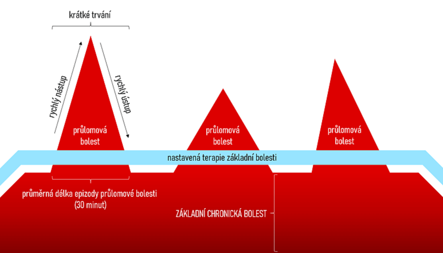 Obecně o průlomové bolesti